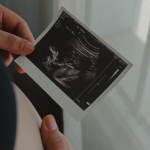 Ultrassom 3D e 4D: conheça com a Dra. Thaline Neves a tecnologia que revolucionou a precisão do diagnóstico fetal.