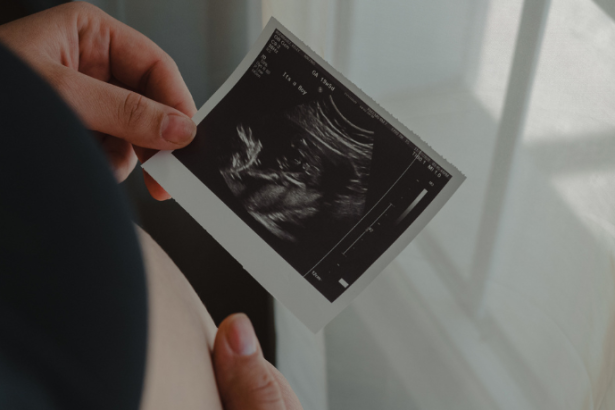 Ultrassom 3D e 4D: conheça com a Dra. Thaline Neves a tecnologia que revolucionou a precisão do diagnóstico fetal.