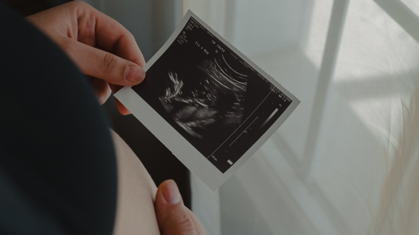 Ultrassom 3D e 4D: conheça com a Dra. Thaline Neves a tecnologia que revolucionou a precisão do diagnóstico fetal.